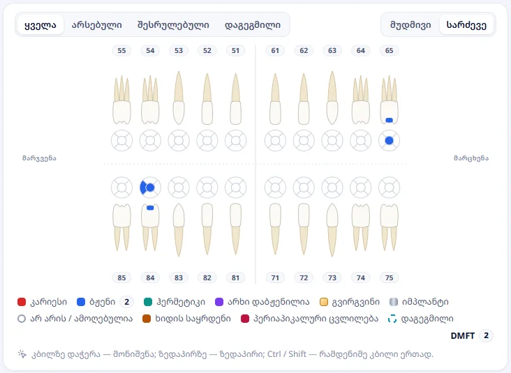 8 წლის ლევან ნოზაძე: სარძევე კბილები (55–85) — ასე იხსნება რუკა 12 წლამდე