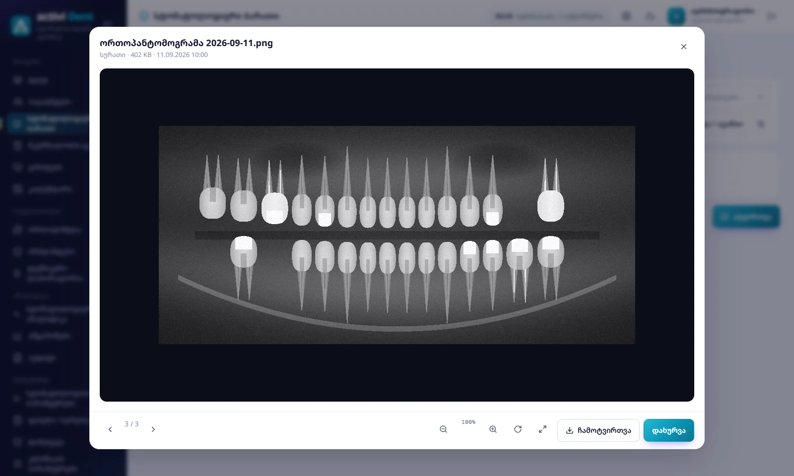 Activi Dent — X-rays and photos